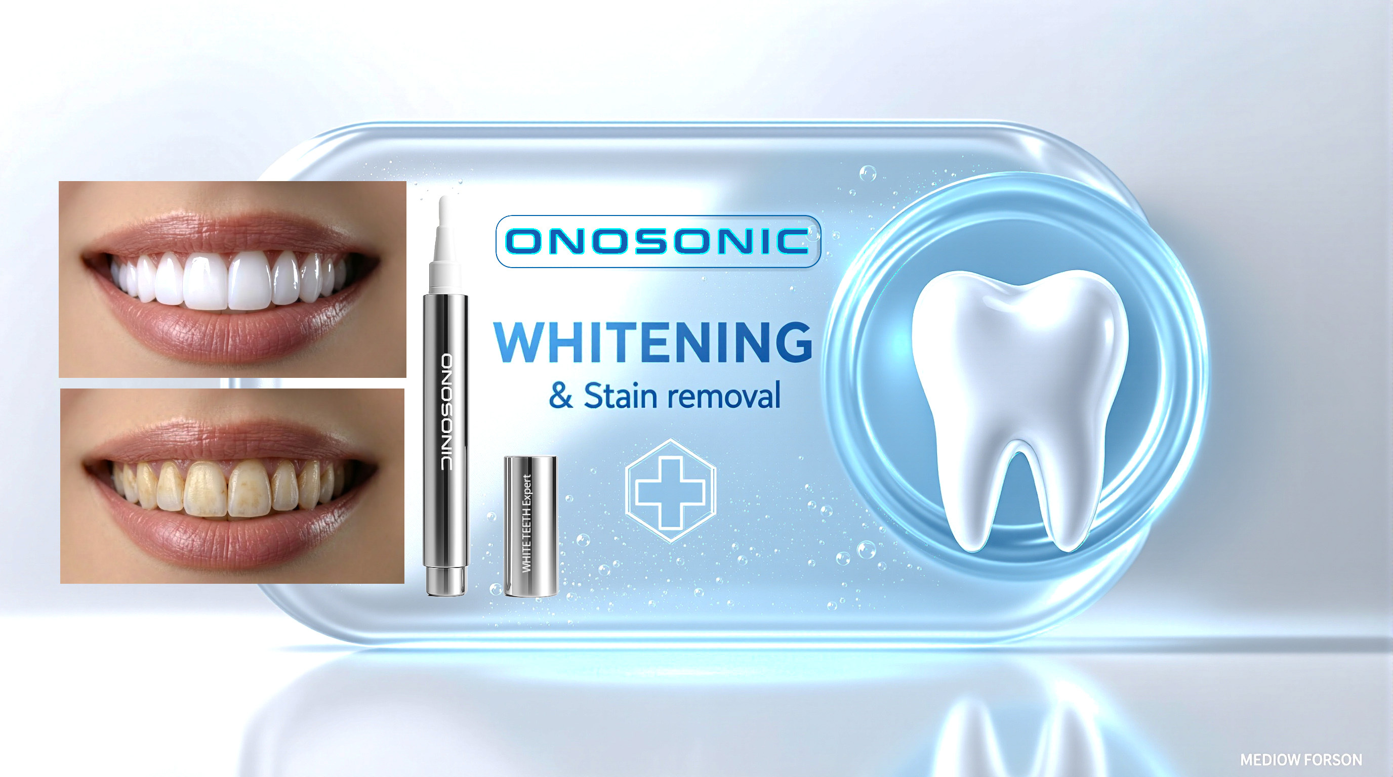 Onosoonic White Teeth Expert Whitening Gel Pen designed for quick and convenient at-home teeth whitening with precision application and stain removal support.